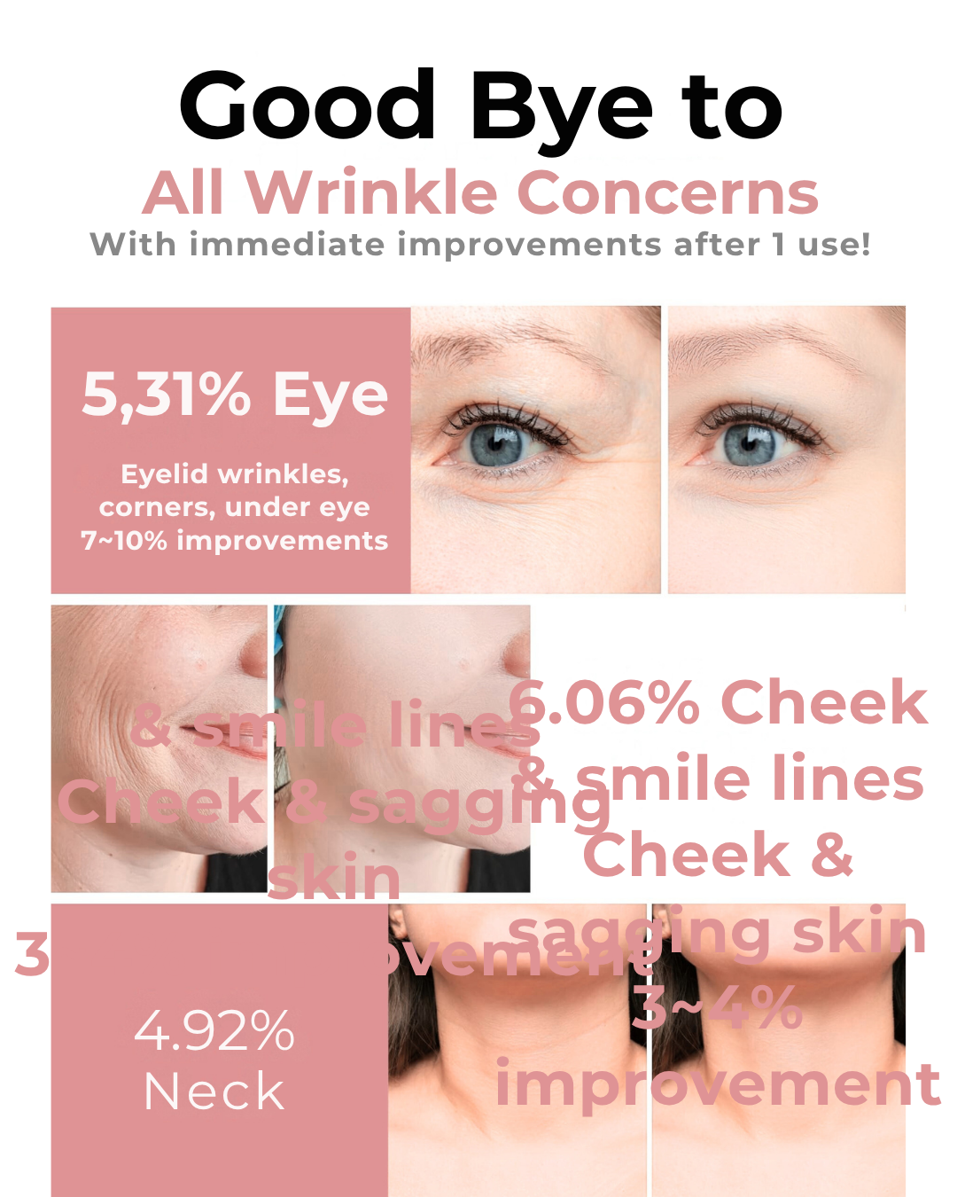 KAHI Korean Botox Kit — Collagen Mist, Multi Balm, Sheet Mask, Blemish Ampoule